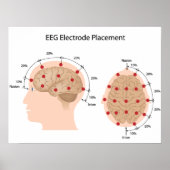 EEG-Elektrodenplatzierungs-Diagramm Poster (Vorne)