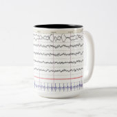 EEG Tasse - Rem-Schlaf (VorderseiteRechts)