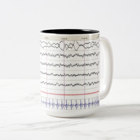 EEG Tasse - Rem-Schlaf (VorderseiteRechts)