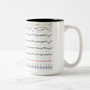 EEG Tasse - Rem-Schlaf