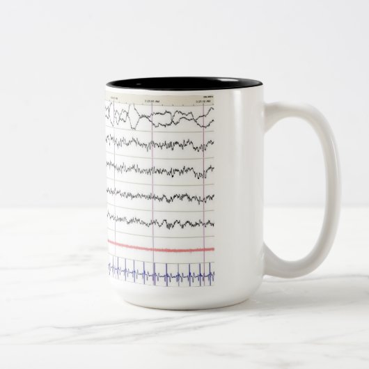 EEG Tasse - Rem-Schlaf (Rechts)