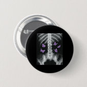 Egirl Xray Skeleton Pink Butterfly Harajuku Y2k Da Button (Vorne & Hinten)