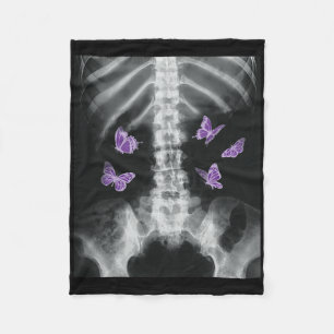 Egirl Xray Skeleton Pink Butterfly Harajuku Y2k Da Fleecedecke