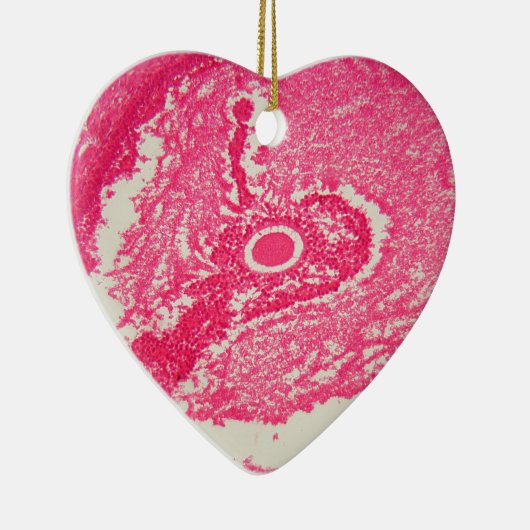 Eierstockzellen unter dem Mikroskop Keramik Ornament (Rechts)