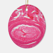 Eierstockzellen unter dem Mikroskop Keramikornament (Links)