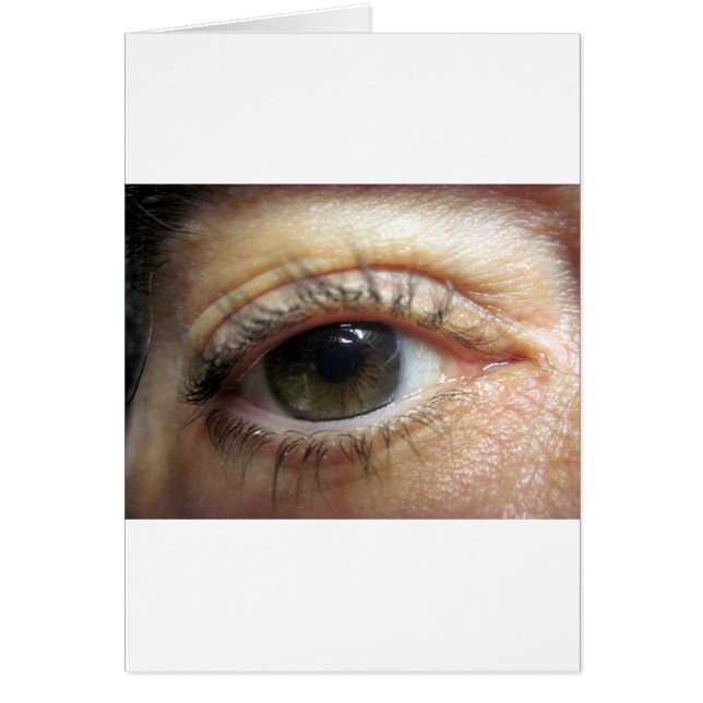 Ein anderes Auge (Vorne)