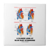 Ein naherer Blick auf blaues Fliese (Vorderseite)