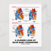 Ein Näherer Blick auf das Blue Baby Syndrom (Herz) Postkarte (Vorderseite)