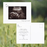 Einfache Funny Ultrasound Baby Dusche Vielen Dank Postkarte<br><div class="desc">Einfache lustige Ultrasound Foto Kinderdusche Danke Postcard. Babyperspektive. Danke vom Baby.</div>