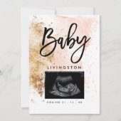 Einzigartiges Sonogramm kommt bald zur neuen Baby- Ankündigung (Vorderseite)