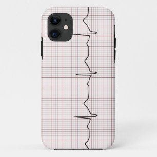 EKG Herzschlag auf Zeichenpapier mit Case-Mate iPhone Hülle