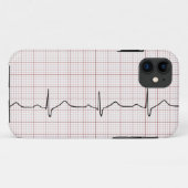 EKG Herzschlag auf Zeichenpapier mit Case-Mate iPhone Hülle (Rückseite (Horizontal))