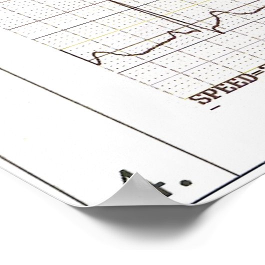 ekg Rhythms Poster (Ecke)