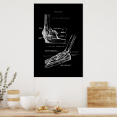 Elbow Joint Orthopädische Wanddekoration Poster (Küche)