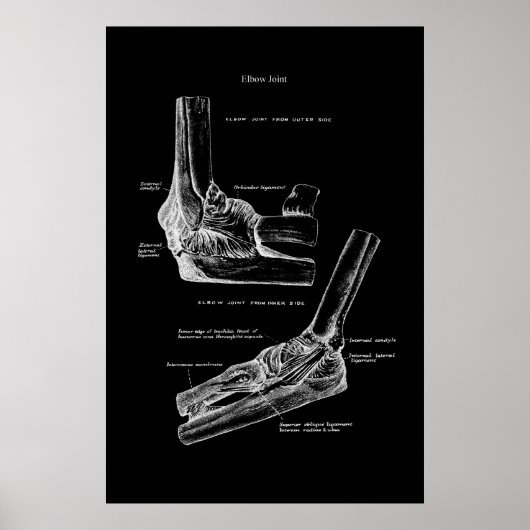 Elbow Joint Orthopädische Wanddekoration Poster (Vorne)