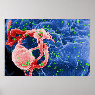 Elektronenmikrograph des HIV-1-Budgetlymphsystems Poster