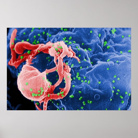 Elektronenmikrograph des HIV-1-Budgetlymphsystems Poster (Vorne)