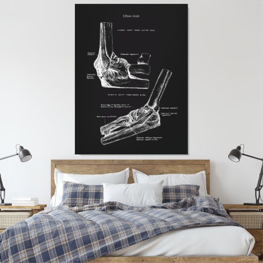 Ellbogen Gemeinsame Anatomie Leinwand Art (Insitu (Schlafzimmer))