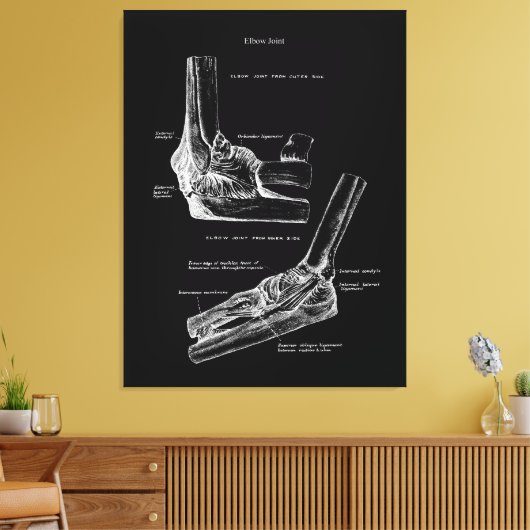 Ellbogen Gemeinsame Anatomie Leinwand Art (Insitu (Wohnzimmer))