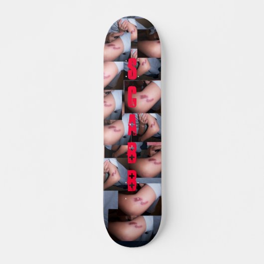 Ellbogen SCABB Skateboard (Vorne)