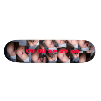 Ellbogen SCABB Skateboard