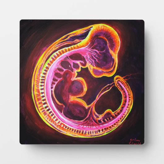 Embryo Fotoplatte (Vorderseite)