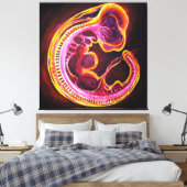 Embryo Leinwanddruck (Insitu (Schlafzimmer))