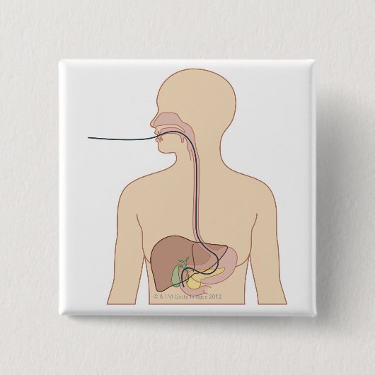 Endoskop Button (Vorderseite)