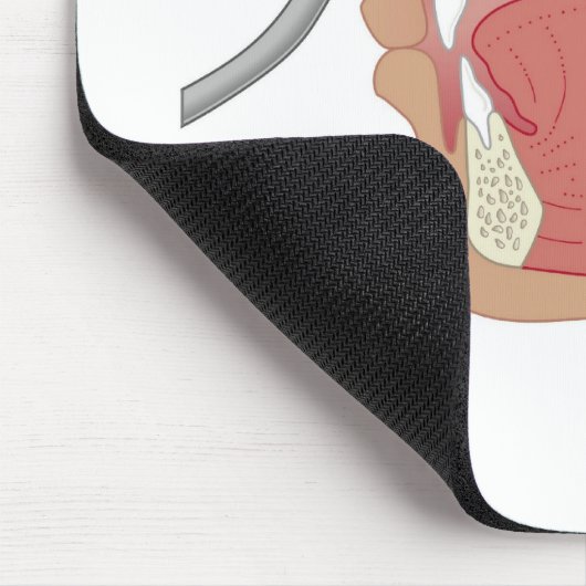 Endoskopie der Nase Mousepad (Ecke)