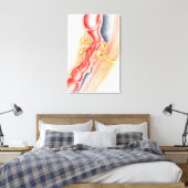 Entwicklung der Fistula Leinwanddruck (Insitu (Schlafzimmer))