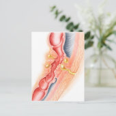 Entwicklung der Fistula Postkarte (Stehend Vorderseite)