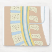 Epidurale Anästhesie Mousepad (Vorne)