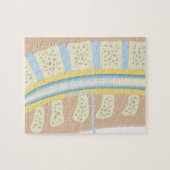 Epidurale Anästhesie Puzzle (Horizontal)