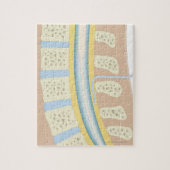 Epidurale Anästhesie Puzzle (Vertikal)