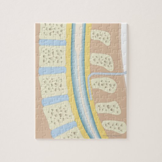 Epidurale Anästhesie Puzzle (Vertikal)