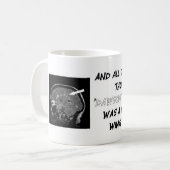 Erhalten Sie mit Ihrer Verletzungs-Last Kaffeetasse (Vorderseite Links)