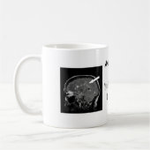 Erhalten Sie mit Ihrer Verletzungs-Last Kaffeetasse (Links)