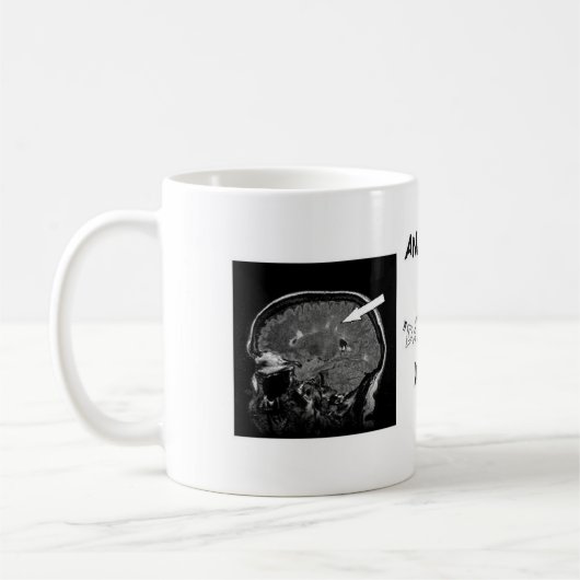 Erhalten Sie mit Ihrer Verletzungs-Last Kaffeetasse (Links)