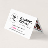 Erinnerung für die Anstellung von Knochenbrüchen n Visitenkarten (Vorderseite)