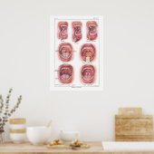 Erkrankungen der Mundanatomie Poster Französisch (Küche)