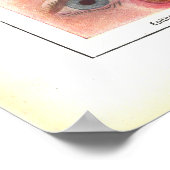 Erkrankungen des Augenanatomie Poster Französisch (Ecke)
