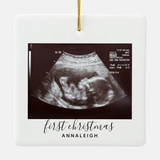 Erste Weihnachtsschwangerschaft Ultrasound Foto Cu Keramikornament (Rückseite)