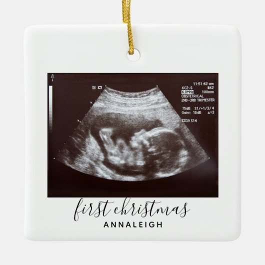Erste Weihnachtsschwangerschaft Ultrasound Foto Cu Keramikornament (Vorderseite)