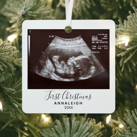 Erste Weihnachtsschwangerschaft Ultrasound Foto Ur Ornament Aus Metall (InSitu)