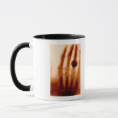 Erste X-Ray, 1901, Fotografie Tasse (Links)