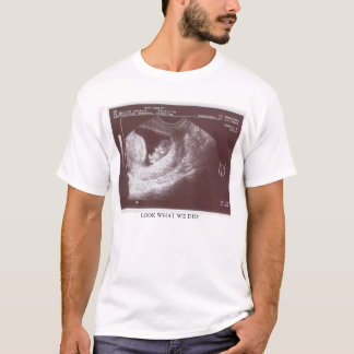 Erstes Babybild Alex u. Angelas T-Shirt