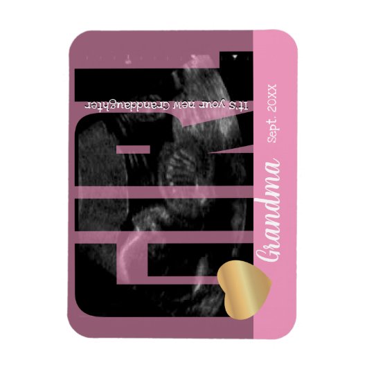 Es ist eine Girl-Ankündigung - Sonogramm mit DIY T Magnet (Vertikal)