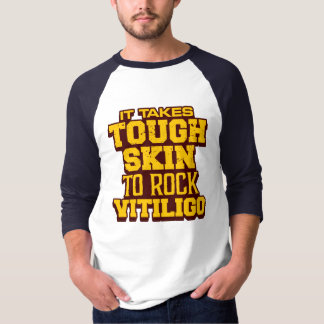 Es nimmt starke Haut zu Felsen vitiligo T-Shirt