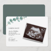 Eukalyptus Pregnancy Baby-Meldung (Vorne/Hinten)