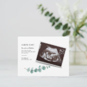 Eukalyptus Schwangerschaft Geschlecht Reveal Baby  (Stehend Vorderseite)